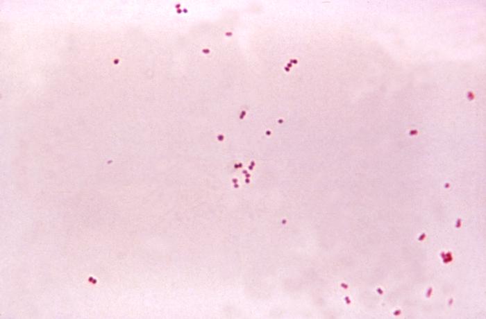 Doença Meningocócica: Neisseria meningitidis.jpg