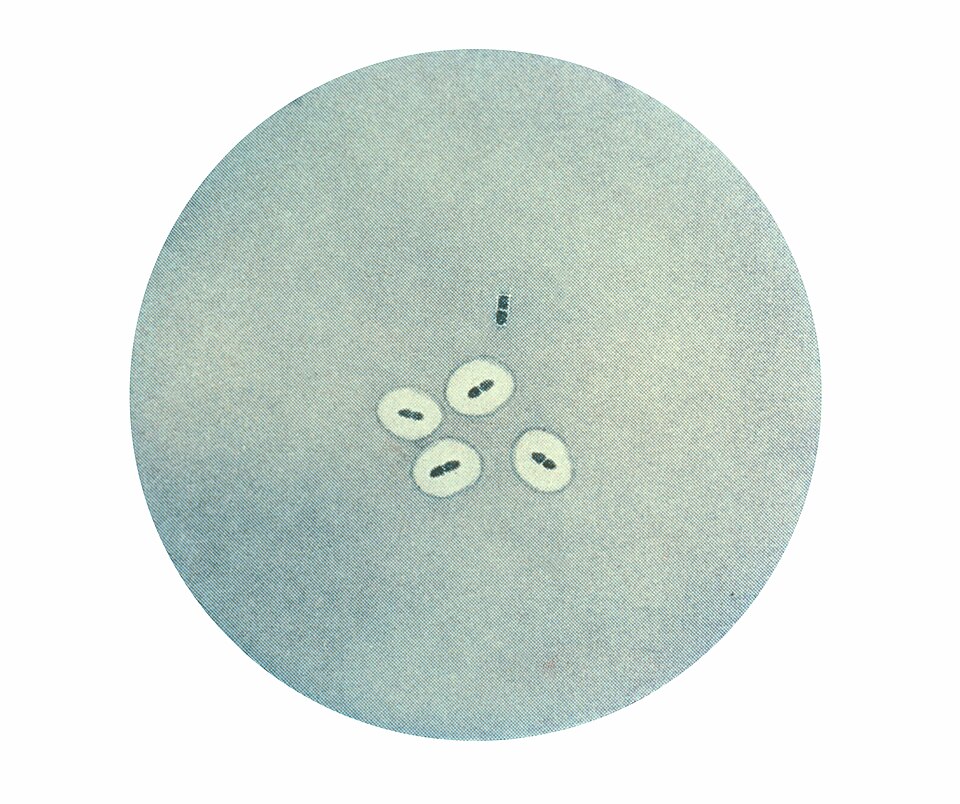 Doença Pneumocócica: Pneumococcus CDC PHIL 2113.jpg