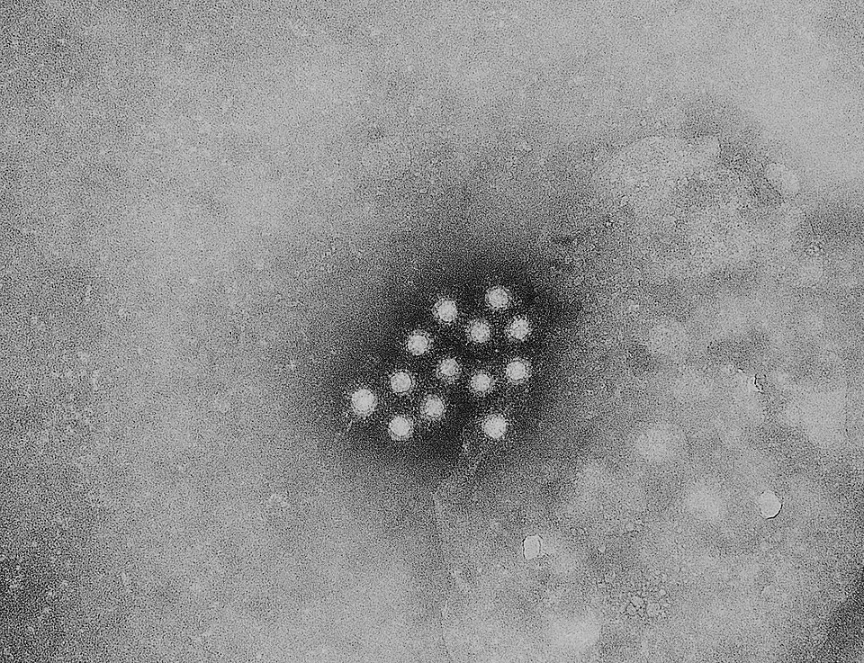 Hepatite A: Hepatitis A virus 01.jpg