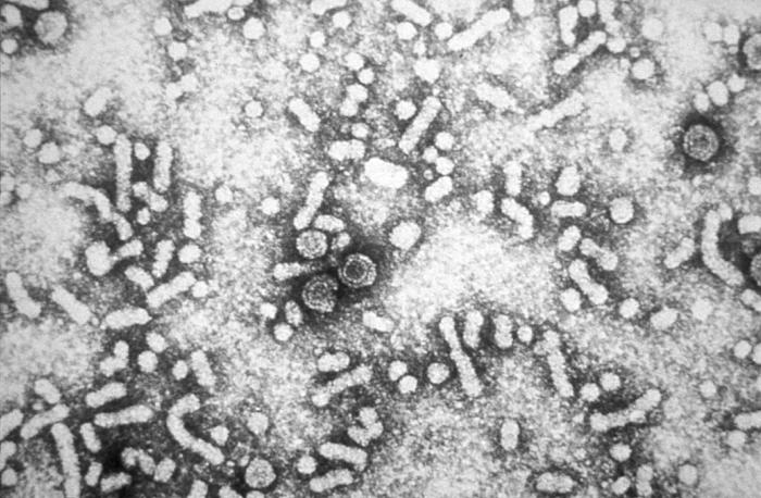 Hepatite B: Hepatitis-B virions.jpg