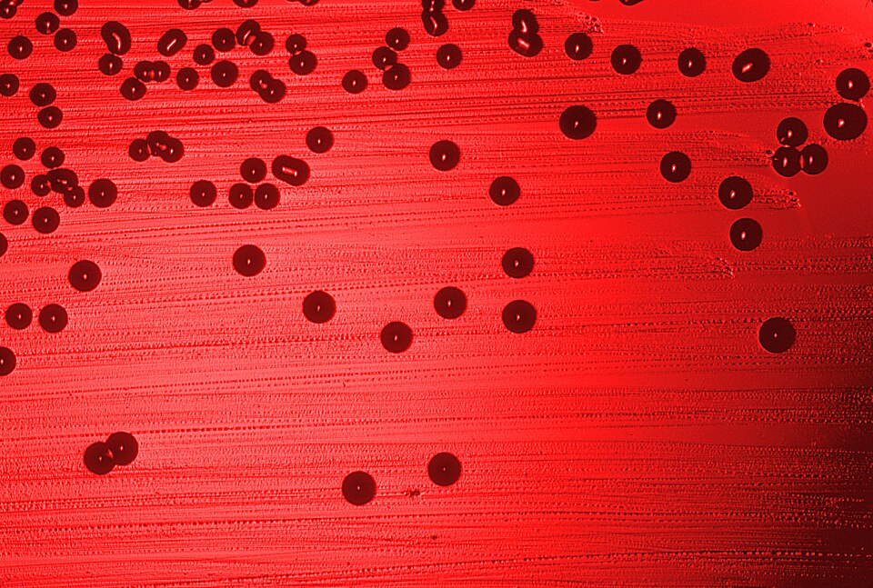 Haemophilus influenzae tipo b (Hib): Haemophilus influenzae 01.jpg