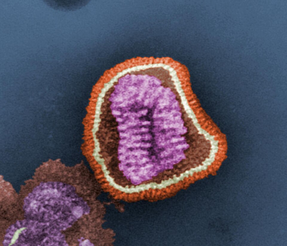 Influenza (Gripe): Influenza virus particle color.jpg
