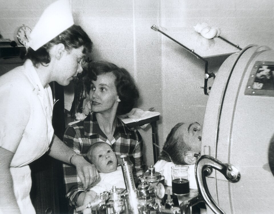 Poliomielite: Polio patient in iron lung (NCP 3631), National Museum of Health and Medicine (284972620).jpg