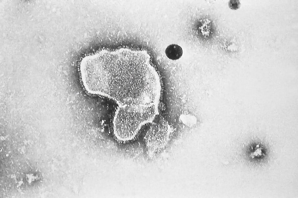 Vírus Sincicial Respiratório (VSR): Respiratory Syncytial Virus (RSV) EM PHIL 2175 lores.jpg